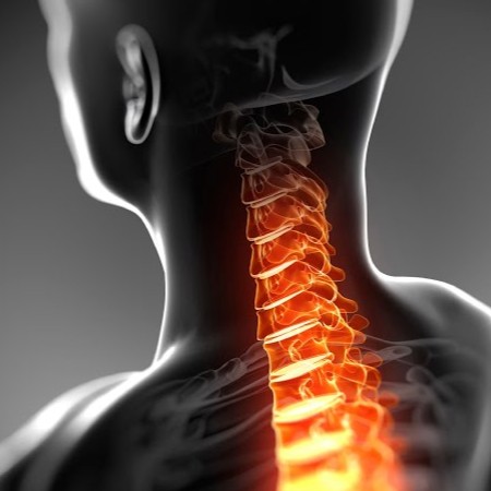 Spinal stenosis and degenerative conditions