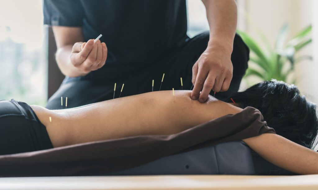 acupuncture back 2000x1200 1